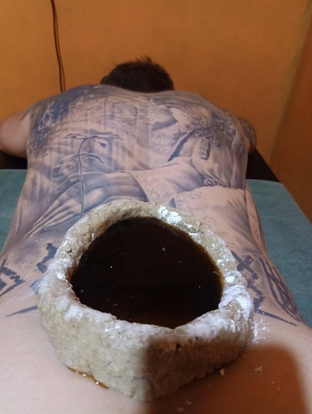 Ayurvedic Kati Basti Treatment